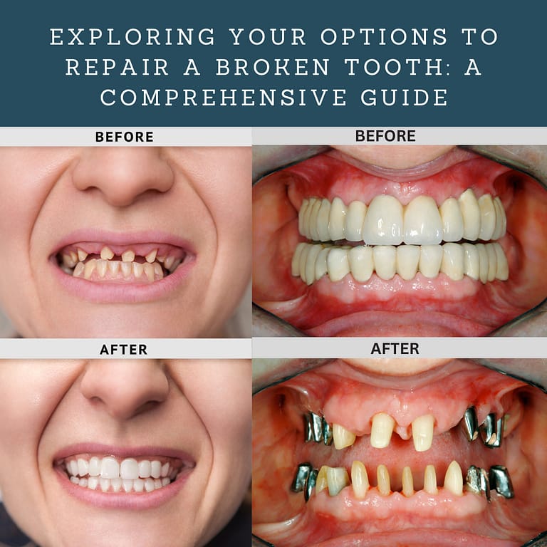 Exploring Your Options to Repair a Broken Tooth: A Comprehensive Guide
