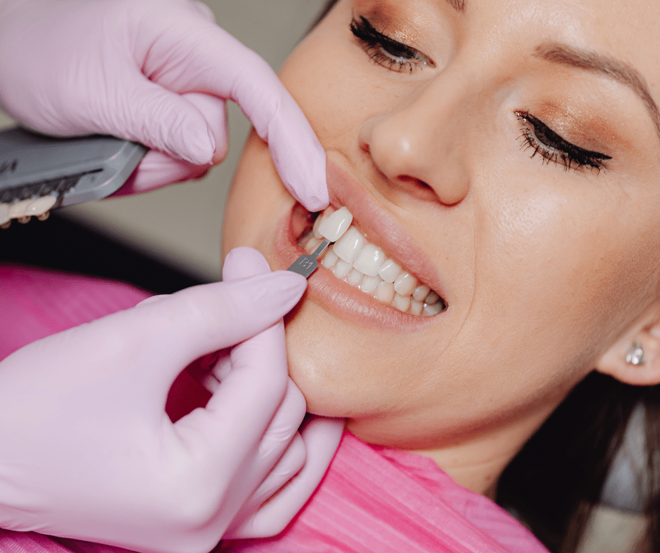 Veneers & laminates at best dental clinic in BTM Layout, bangalore